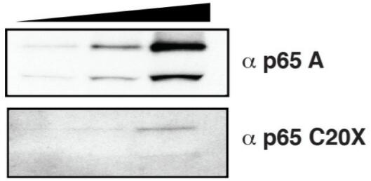 Western blot analysis of the recombinant NFkBp65 preparation to check the specificity of two anti-NFkBp65 antibodies: A and C20X. NFkBp65 (25, 50, and 100 ng) was resolved on a NuPAGE 4 - 12% PAGE in MOPs buffer and subjected to Western blot.